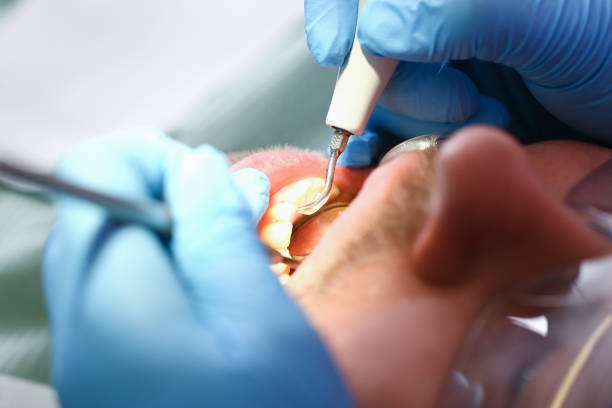 Best Pediatric Emergency Dentist in Rural Hall, NC