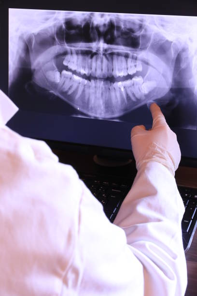 Best Emergency Wisdom Teeth Removal in Rural Hall, NC