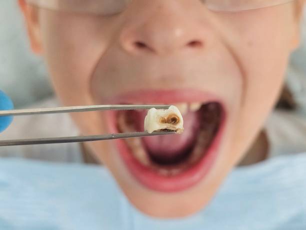 Best Emergency Treatment for Toothache in Rural Hall, NC